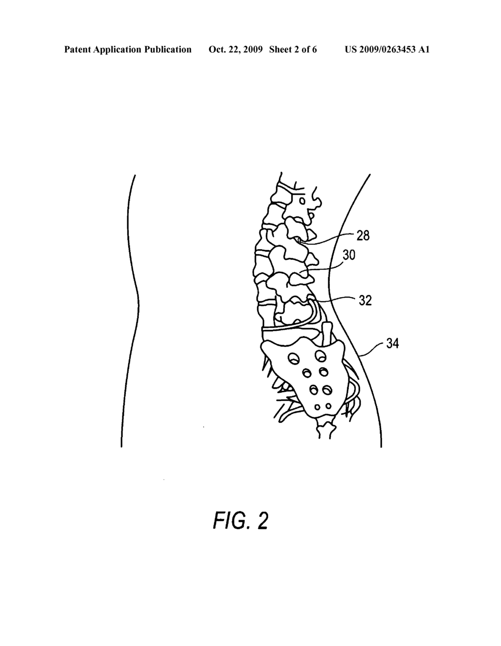 Methods and Compositions for Treating Pain Comprising a Statin - diagram, schematic, and image 03