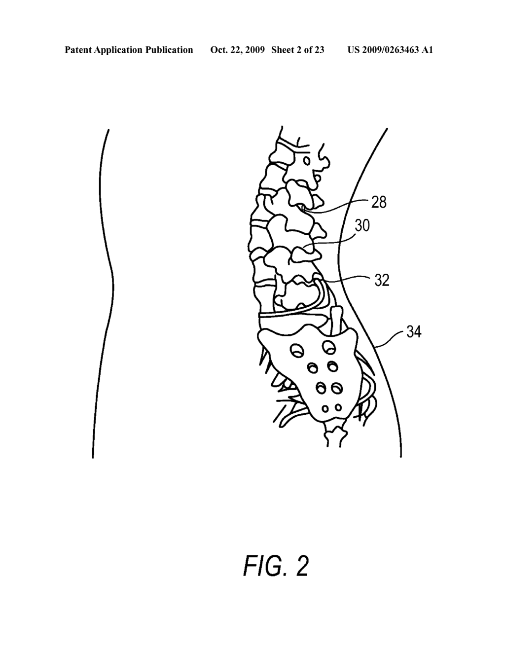 ALPHA ADRENERGIC RECEPTOR AGONISTS FOR TREATMENT OF PAIN AND/OR INFLAMMATION - diagram, schematic, and image 03