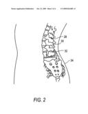 ANALGESIC AND ANTI-INFLAMMATORY COMPOSITIONS AND METHODS FOR REDUCING, PREVENTING OR TREATING PAIN AND INFLAMMATION diagram and image