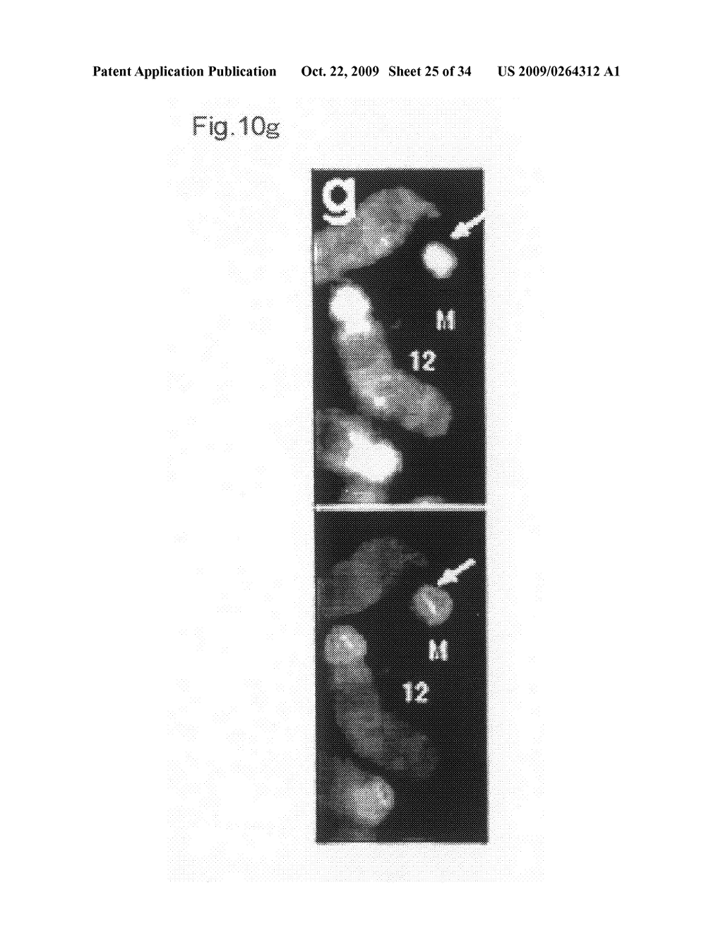 METHOD FOR REMOVING DESIRED CHROMOSOME AND TAILOR-MADE MEDICAL TREATMENT UTILIZING THE SAME - diagram, schematic, and image 26