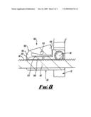 SURGICAL APPARATUS diagram and image