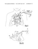 METHOD AND APPARATUS FOR MAPPING A STRUCTURE diagram and image