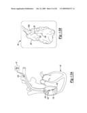 METHOD AND APPARATUS FOR MAPPING A STRUCTURE diagram and image