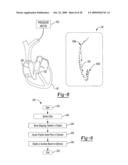 Interference Blocking and Frequency Selection diagram and image