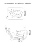 Interference Blocking and Frequency Selection diagram and image