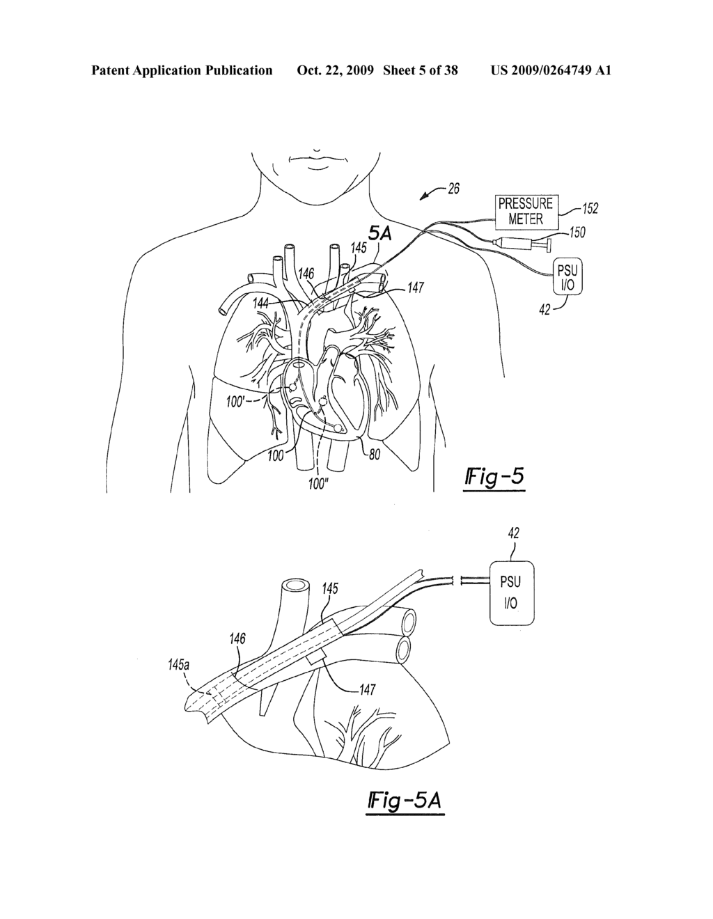 IDENTIFYING A STRUCTURE FOR CANNULATION - diagram, schematic, and image 06