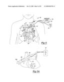 LOCATING A MEMBER IN A STRUCTURE diagram and image