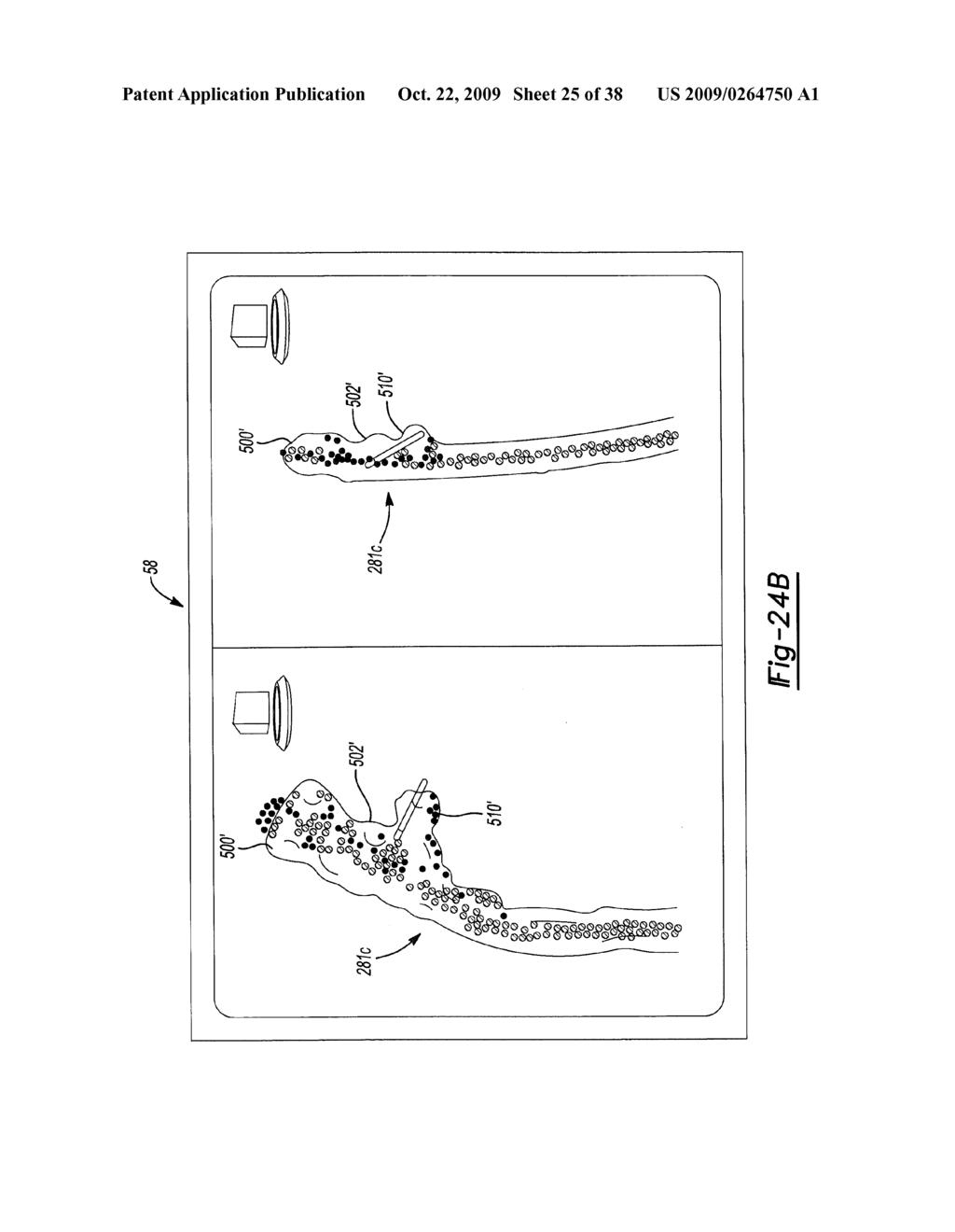 LOCATING A MEMBER IN A STRUCTURE - diagram, schematic, and image 26