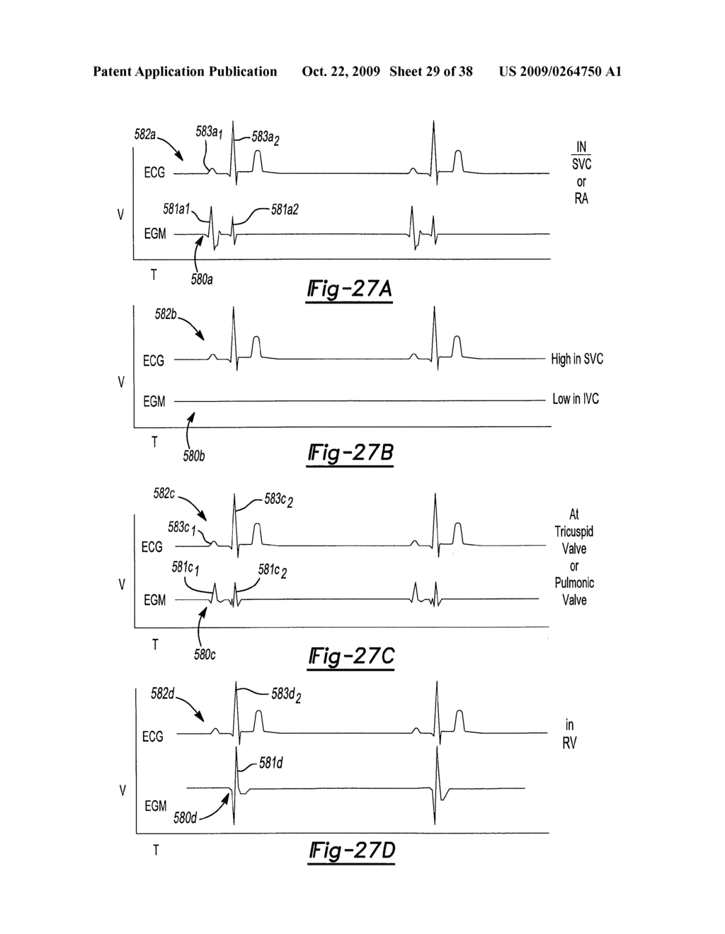 LOCATING A MEMBER IN A STRUCTURE - diagram, schematic, and image 30