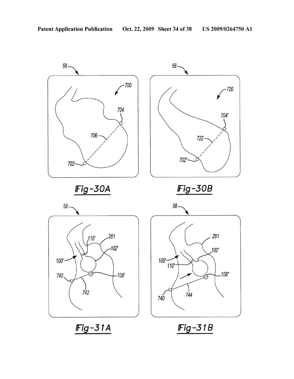 LOCATING A MEMBER IN A STRUCTURE - diagram, schematic, and image 35