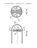 Scanning mechanisms for imaging probe diagram and image