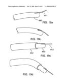 Scanning mechanisms for imaging probe diagram and image