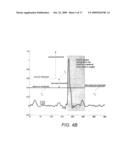 SYSTEMS AND METHODS FOR IMPROVED ATRIAL FIBRILLATION (AF) MONITORING diagram and image