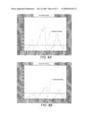 SYSTEMS AND METHODS FOR IMPROVED ATRIAL FIBRILLATION (AF) MONITORING diagram and image