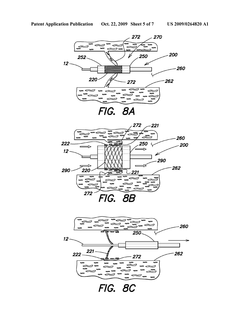 METHOD AND APPARATUS FOR IMPLANTING AN ENDOLUMINAL PROSTHESIS SUCH AS A PROSTHETIC VALVE - diagram, schematic, and image 06