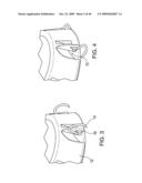 METHODS OF IMPLANTING AN INJECTION PORT diagram and image