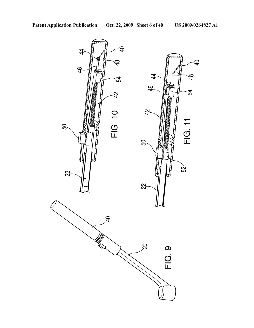 METHODS OF IMPLANTING AN INJECTION PORT - diagram, schematic, and image 07