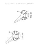 METHODS OF IMPLANTING AN INJECTION PORT diagram and image