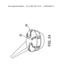 METHODS OF IMPLANTING AN INJECTION PORT diagram and image