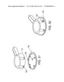 METHODS OF IMPLANTING AN INJECTION PORT diagram and image