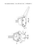 METHODS OF IMPLANTING AN INJECTION PORT diagram and image