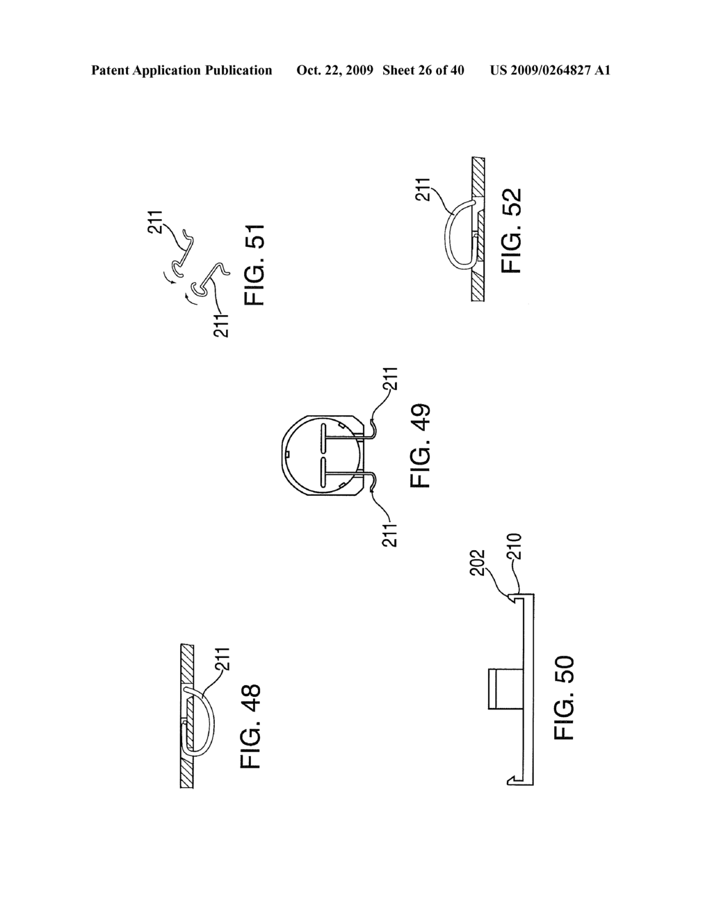 METHODS OF IMPLANTING AN INJECTION PORT - diagram, schematic, and image 27