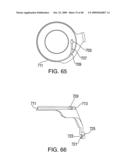 METHODS OF IMPLANTING AN INJECTION PORT diagram and image