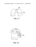 METHODS OF IMPLANTING AN INJECTION PORT diagram and image