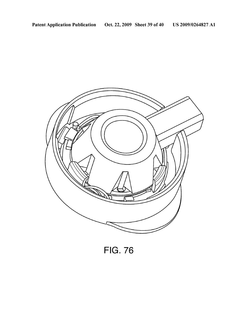 METHODS OF IMPLANTING AN INJECTION PORT - diagram, schematic, and image 40