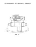 METHODS OF IMPLANTING AN INJECTION PORT diagram and image