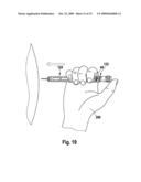 Drug Delivery Device Dose Setting Mechanism diagram and image