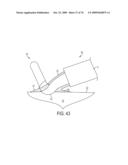 Fluid-Assisted Medical Devices, Systems and Methods diagram and image