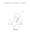 Fluid-Assisted Medical Devices, Systems and Methods diagram and image