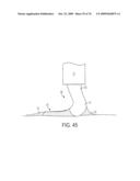 Fluid-Assisted Medical Devices, Systems and Methods diagram and image