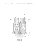 Fluid-Assisted Medical Devices, Systems and Methods diagram and image