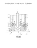 Fluid-Assisted Medical Devices, Systems and Methods diagram and image