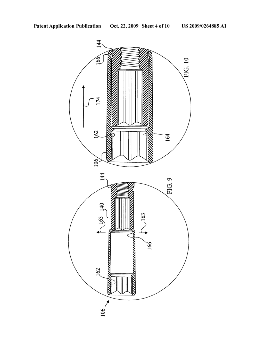 Orthopaedic trauma hip screw assembly - diagram, schematic, and image 05