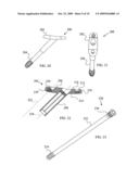 Orthopaedic trauma hip screw assembly diagram and image