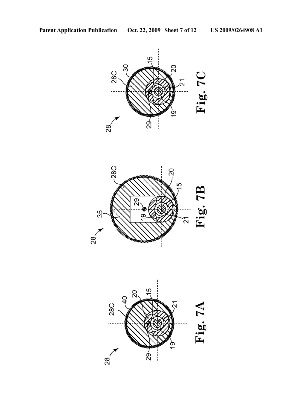 METHOD AND APPARATUS FOR INCREASING ROTATIONAL AMPLITUDE OF ABRASIVE ELEMENT ON HIGH-SPEED ROTATIONAL ATHERECTOMY DEVICE - diagram, schematic, and image 08