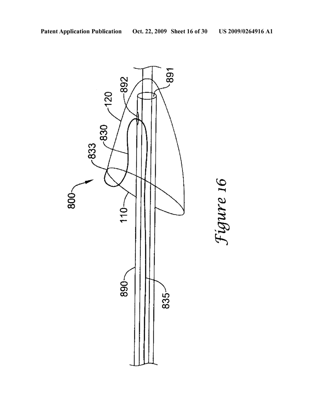 EMBOLIC PROTECTION FILTER WITH REDUCED LANDING ZONE - diagram, schematic, and image 17