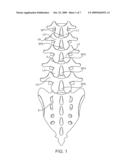 METHODS AND SYSTEMS FOR CONSTRAINT OF MULTIPLE SPINE SEGMENTS diagram and image