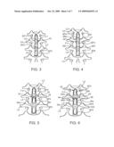 METHODS AND SYSTEMS FOR CONSTRAINT OF MULTIPLE SPINE SEGMENTS diagram and image