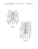 METHODS AND SYSTEMS FOR CONSTRAINT OF MULTIPLE SPINE SEGMENTS diagram and image