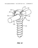 ANCHORS FOR SECURING A ROD TO A VERTEBRAL MEMBER diagram and image