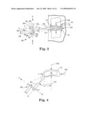 INSTRUMENT SET AND METHOD FOR PERFORMING SPINAL NUCLECTOMY diagram and image