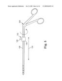 INSTRUMENT SET AND METHOD FOR PERFORMING SPINAL NUCLECTOMY diagram and image