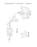 INSTRUMENT SET AND METHOD FOR PERFORMING SPINAL NUCLECTOMY diagram and image