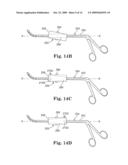 INSTRUMENT SET AND METHOD FOR PERFORMING SPINAL NUCLECTOMY diagram and image