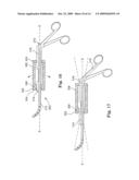 INSTRUMENT SET AND METHOD FOR PERFORMING SPINAL NUCLECTOMY diagram and image