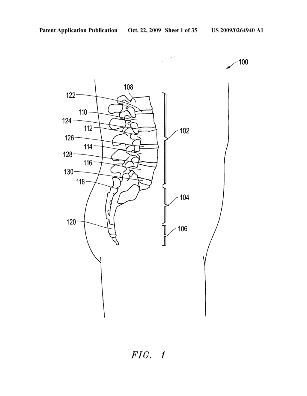 SURGICAL TOOL - diagram, schematic, and image 02